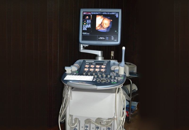 4-d ultrasound scanner